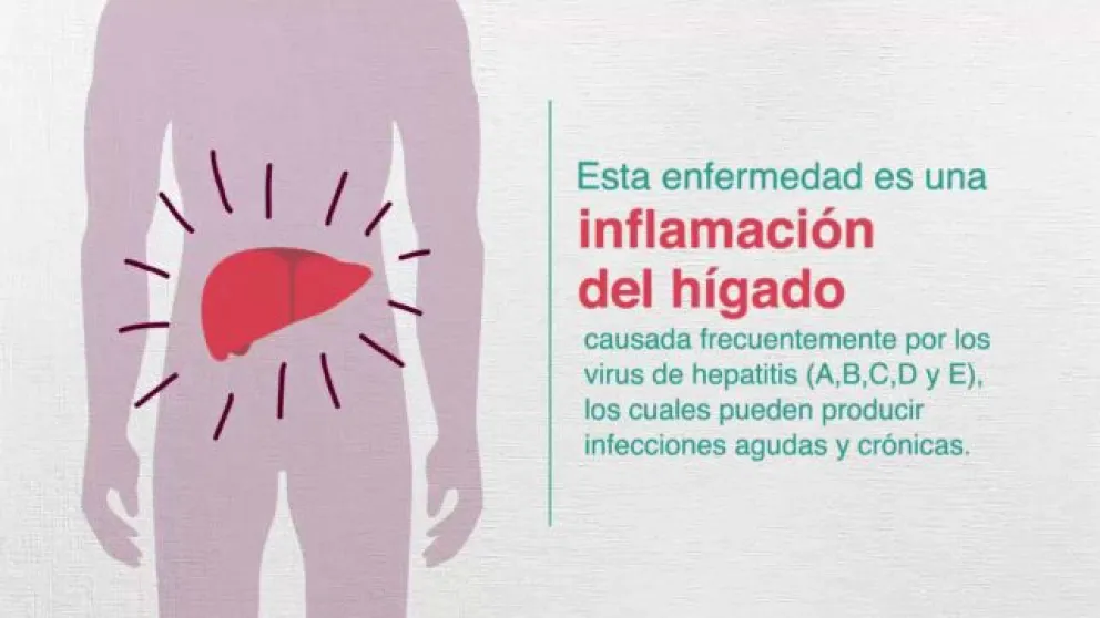 Hepatitis: cuáles son los tipos, sus síntomas y tratamientos