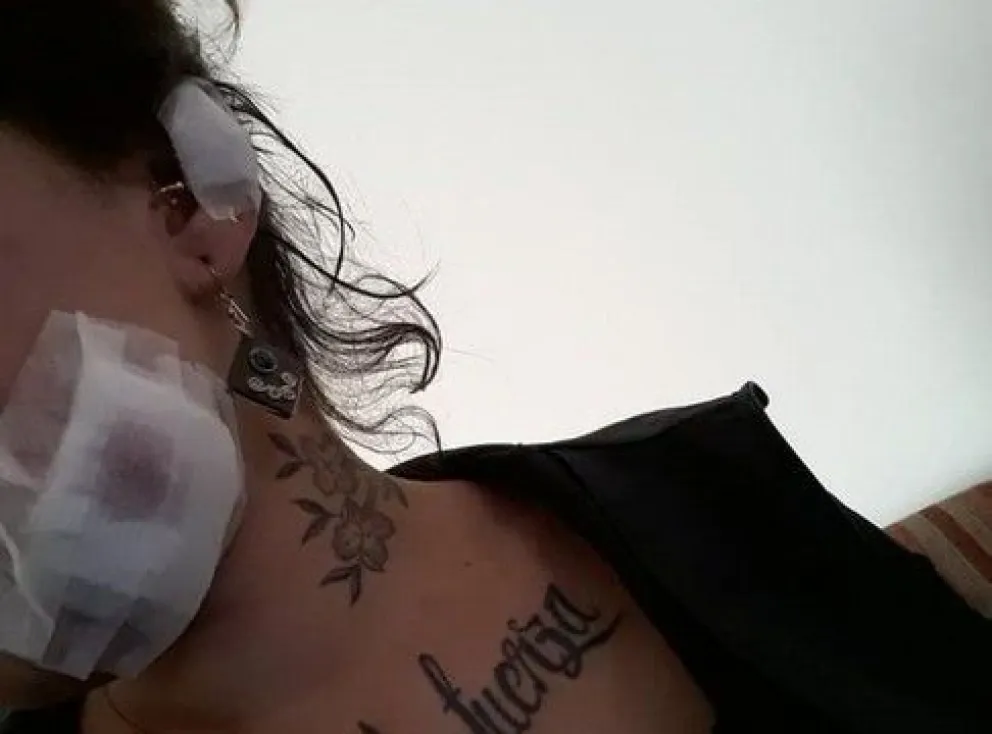 Salvaje ataque con una botella por llevar el pañuelo verde