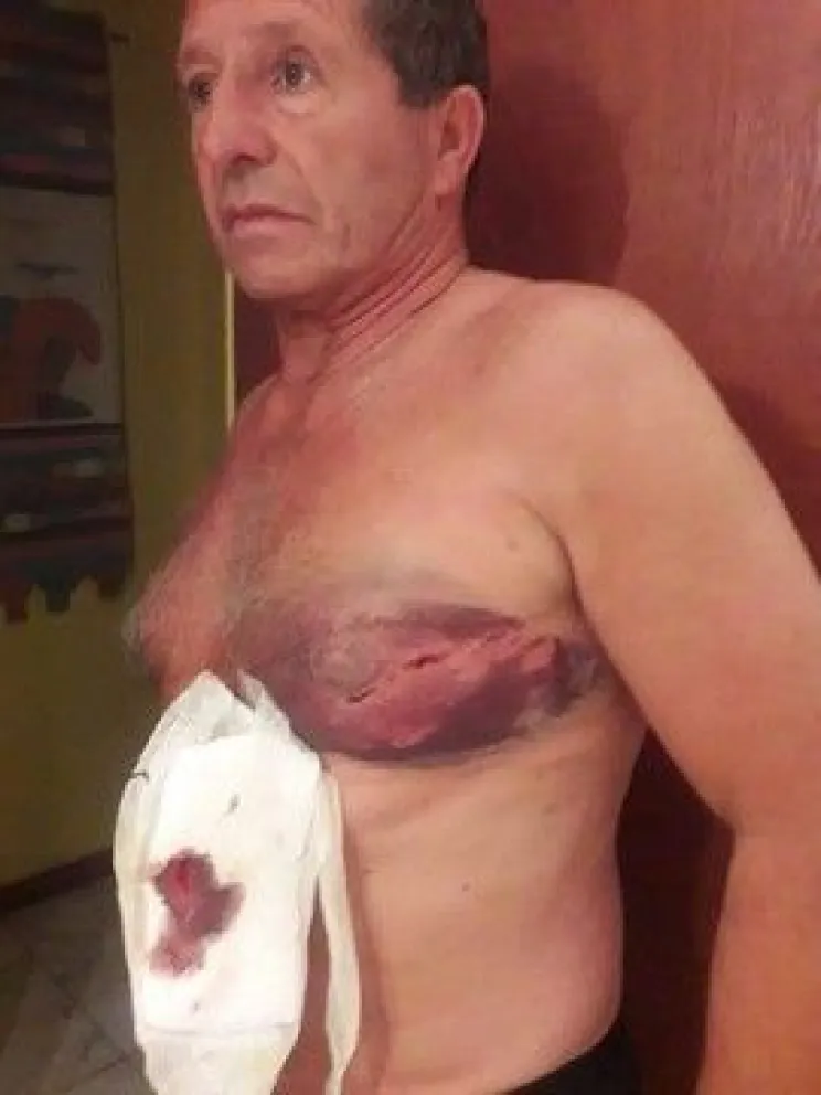Un perro mordió a un vecino en la costanera
