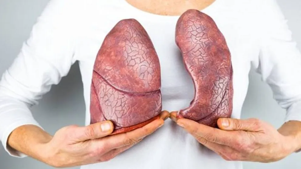Qué es la fibrosis quística, sus síntomas y tratamiento