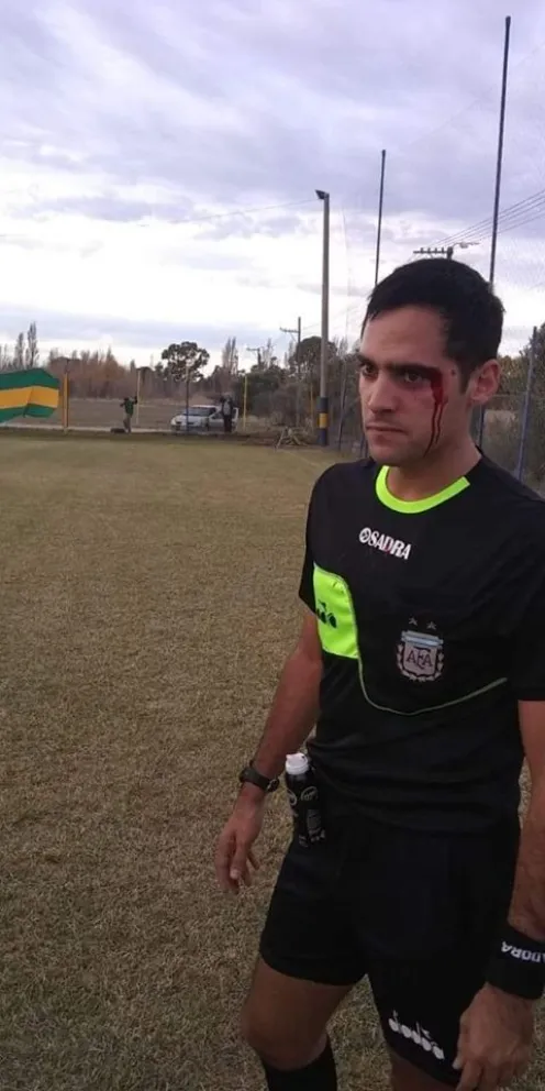 Fortín fue eliminado del torneo por la agresión al árbitro