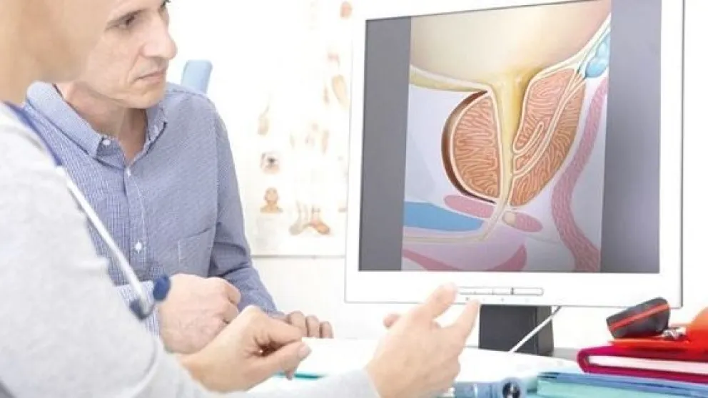 Cáncer de próstata: el diagnóstico revirtió su mortalidad