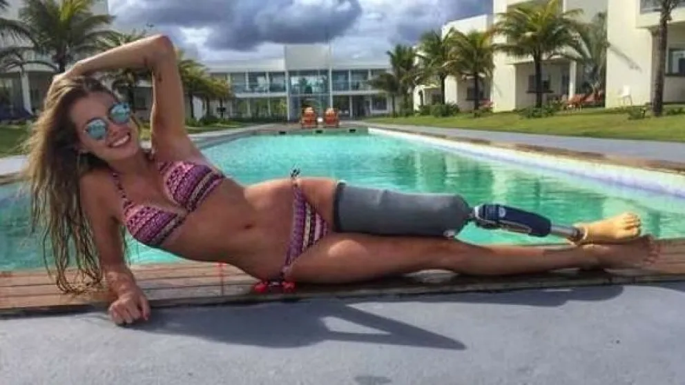 Paola Antonini, la modelo con pierna biónica que triunfa en las redes