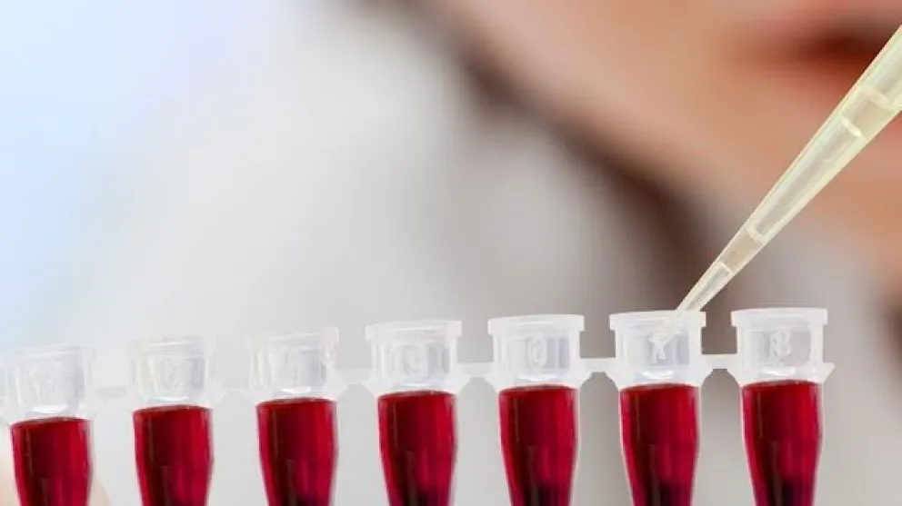 ¿Sabés qué es la sangre dorada?