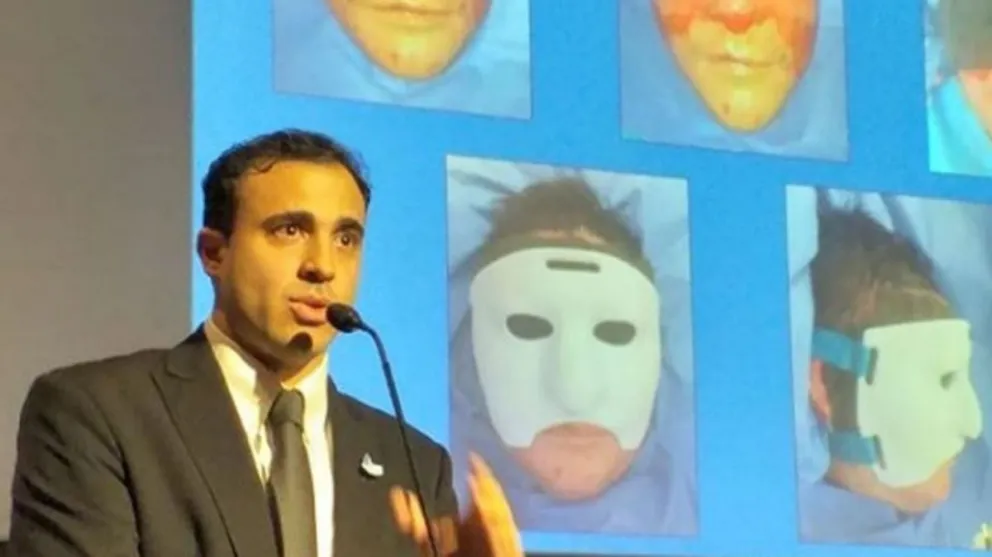 Argentinos crearon una máscara 3D para reconstrucción facial