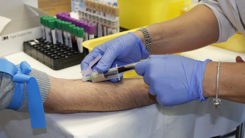 La sangre más rara y costosa del mundo ¿de qué color es?