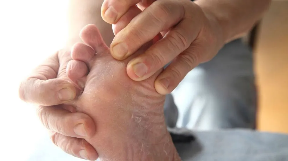 ¿Por qué los pies pueden tener tan mal olor?