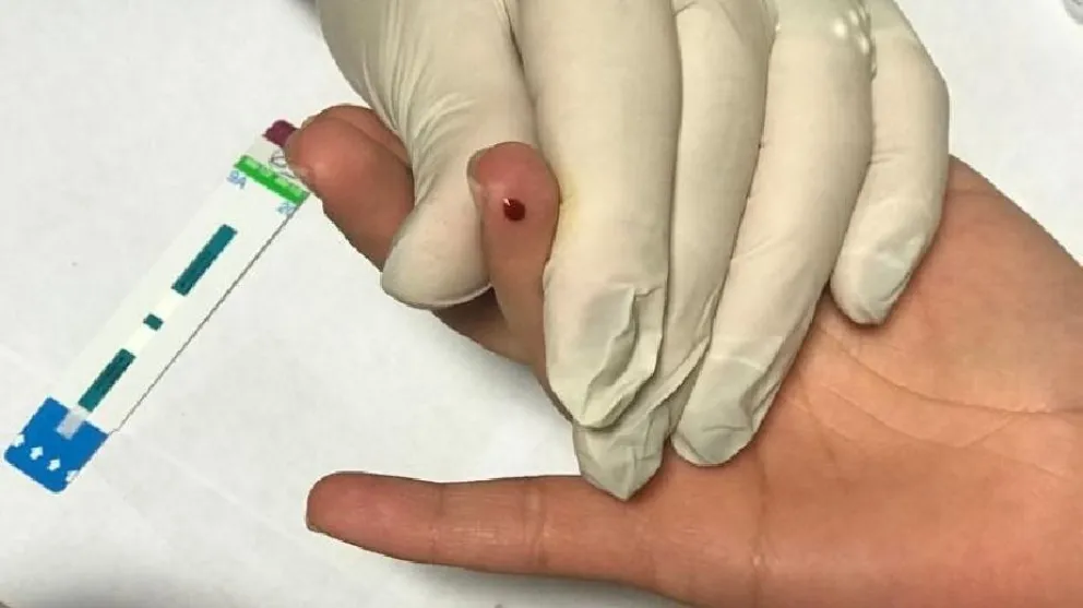 ¿En qué consiste el Test Rápido para VIH?