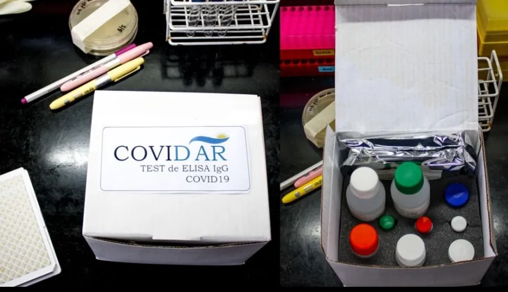 Crean Primer test serológico del país para coronavirus SARS-CoV-2
