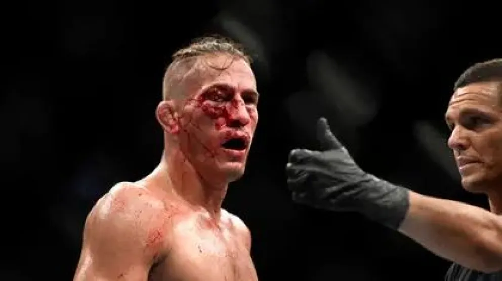 Impactante lesión en el rostro de un luchador de UFC