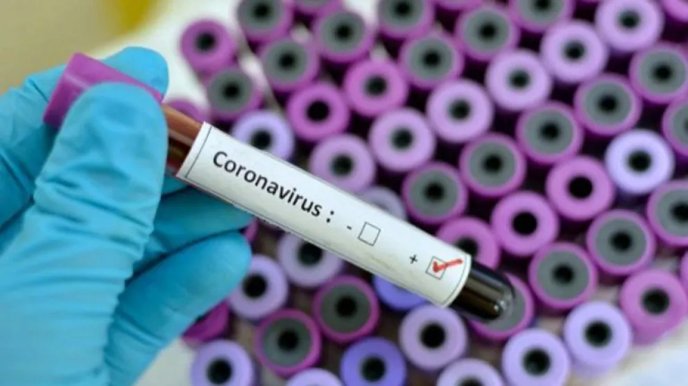 Falleció una mujer de Allen por coronavirus
