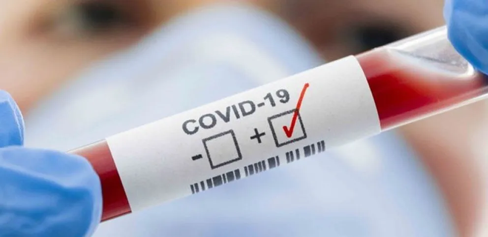 Récord de contagios de coronavirus en Viedma: hay 26 activos