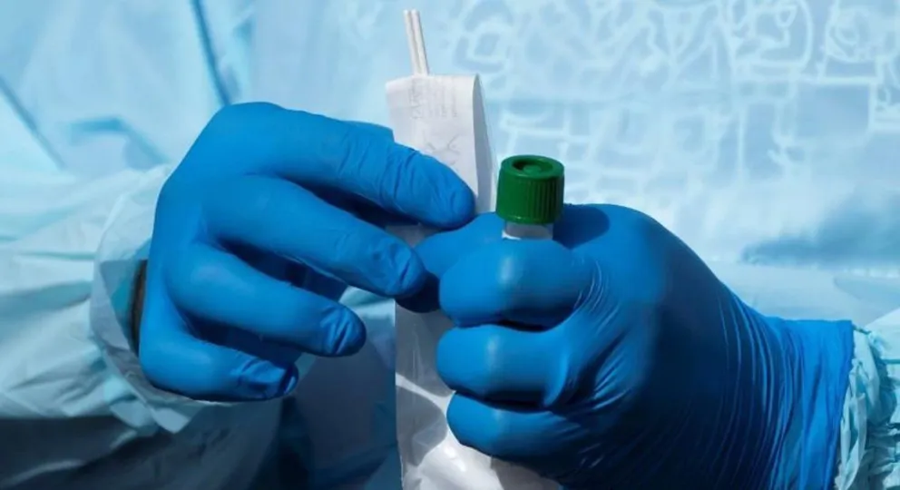 Oxford desarrolló un test de coronavirus que da resultados en 5 minutos