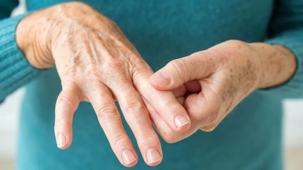 Artritis Reumatoidea, una lucha diaria de acompañamiento