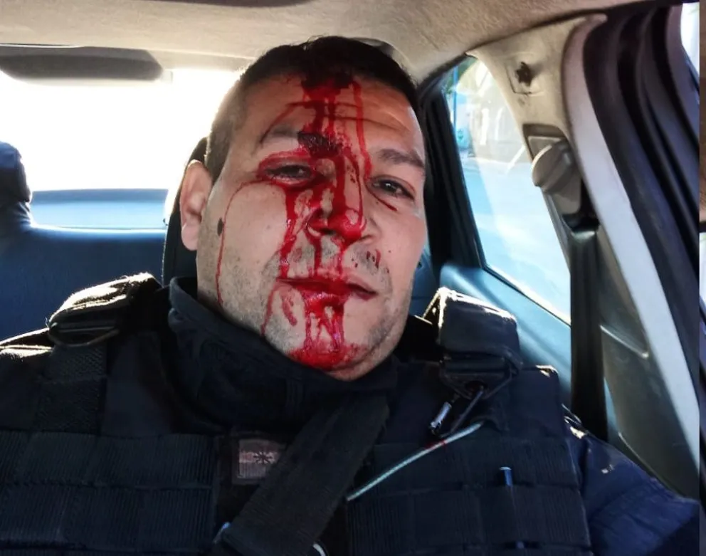 El otro lado del desalojo: varios policías heridos y un patrullero destrozado