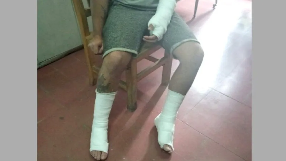 Capataz violento: tiró a un albañil desde un segundo piso por hacer mal una losa