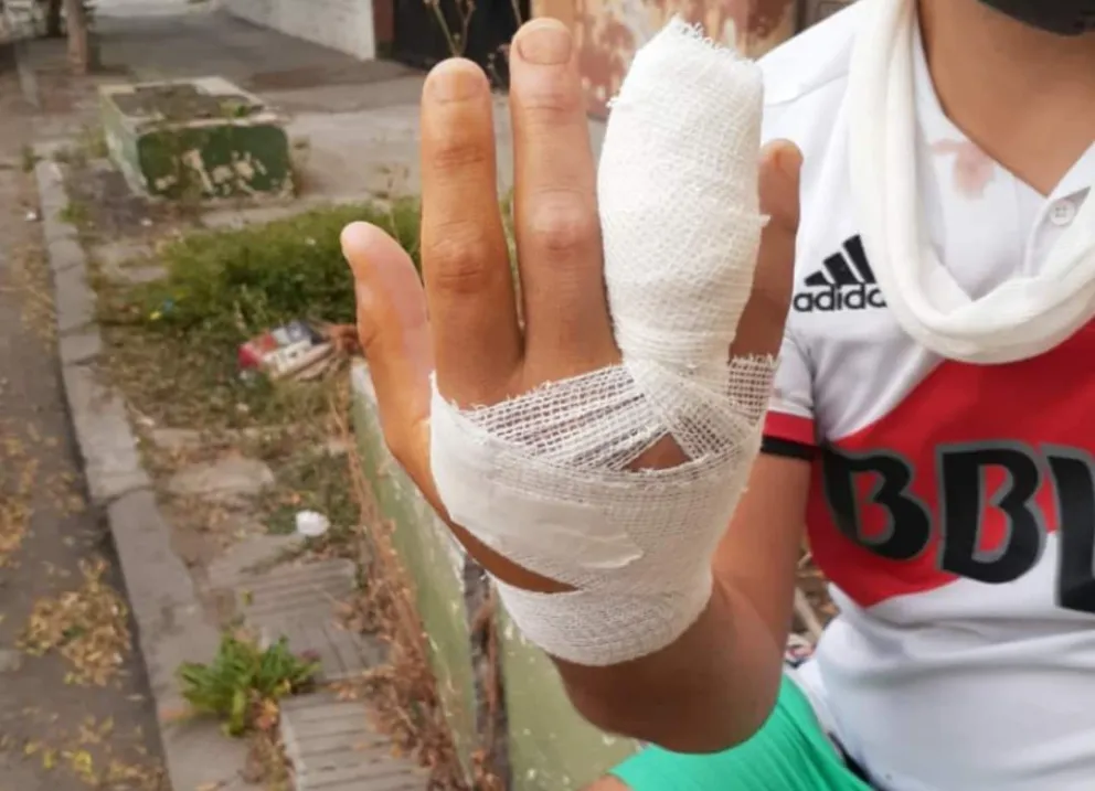 Un joven perdió la falange de un dedo tras una pelea de perros en la costanera