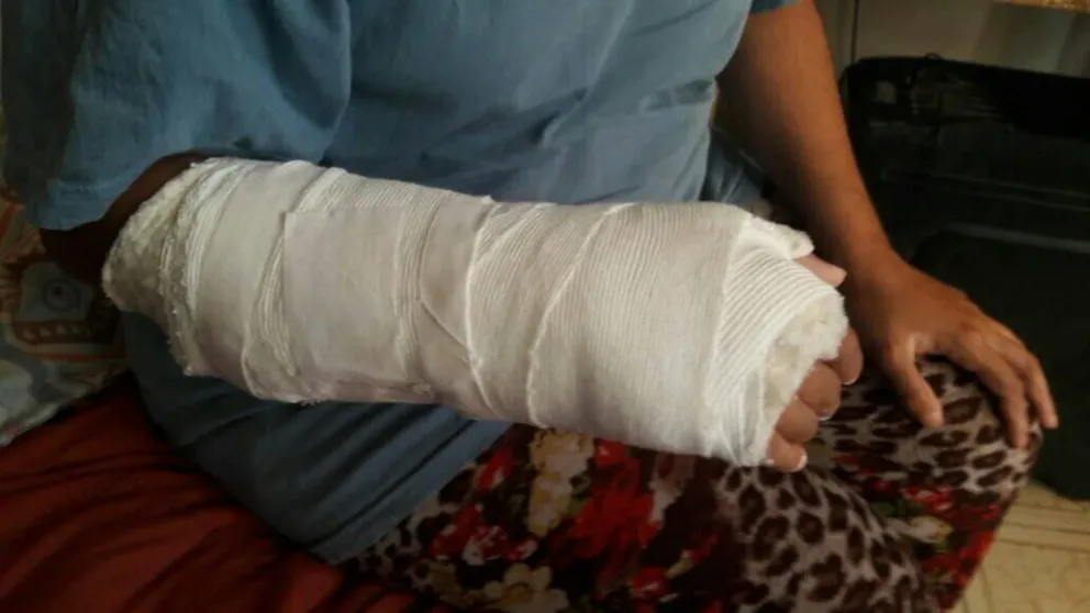 Violinista de Viedma se quebró la mano y necesita ayuda para la operación