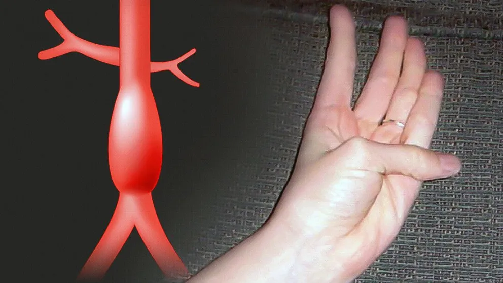 ¡Sorprendente! Podés detectar un problema cardiovascular moviendo solo un dedo