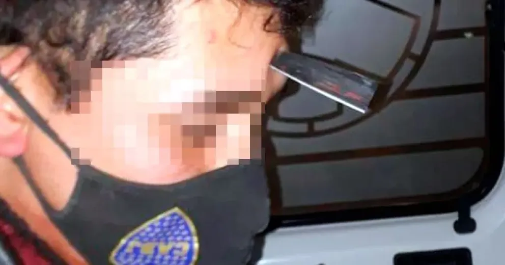 Impactante video de un hombre con un cuchillo clavado en la frente
