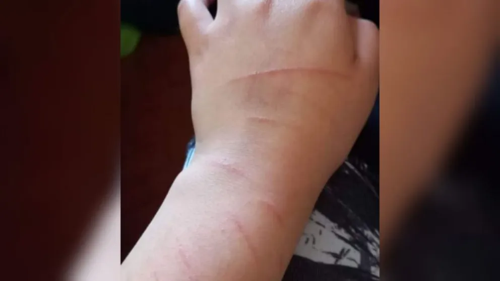 Una joven sufrió una brutal agresión por parte de su pareja, teme por su vida