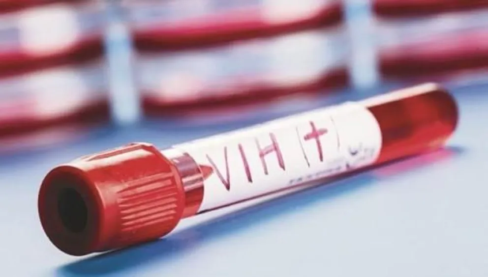 Alta preocupación: Dos de cada tres personas con VIH no saben que lo tienen