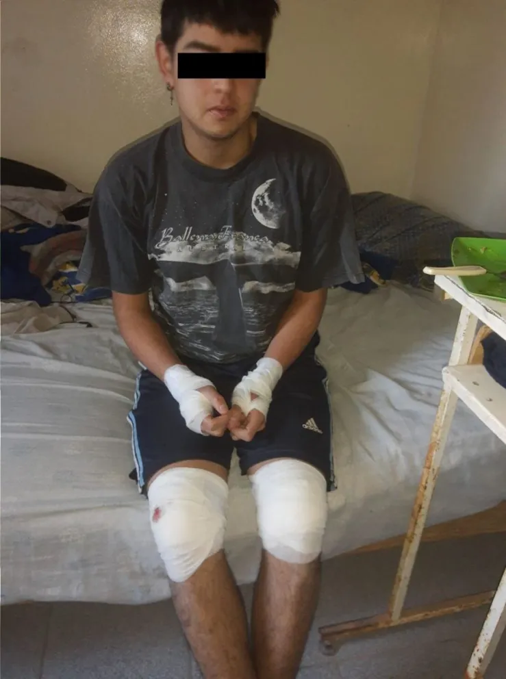 Un chico sufrió graves heridas por un perro suelto