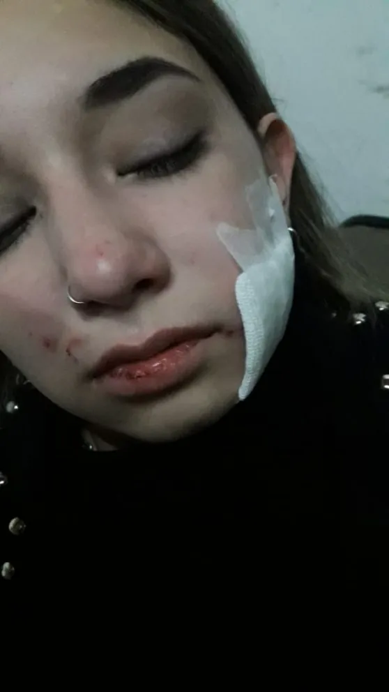 Le robaron y le clavaron una tijera en la cara "por ser linda"