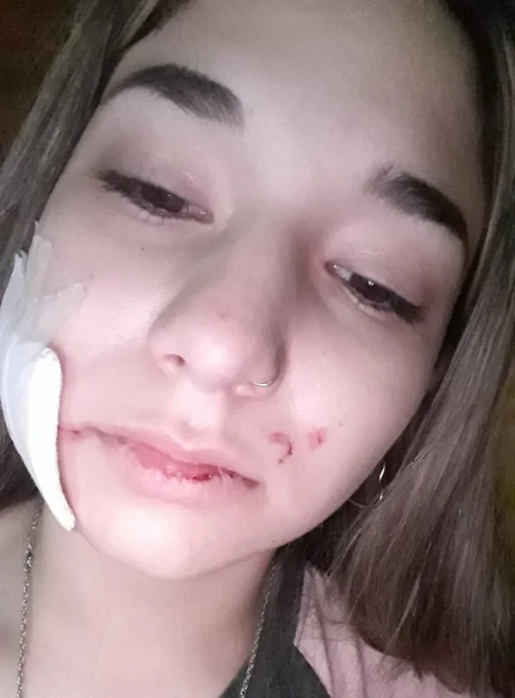 Chica atacada con una tijera: "Pensé que no la contaba más"
