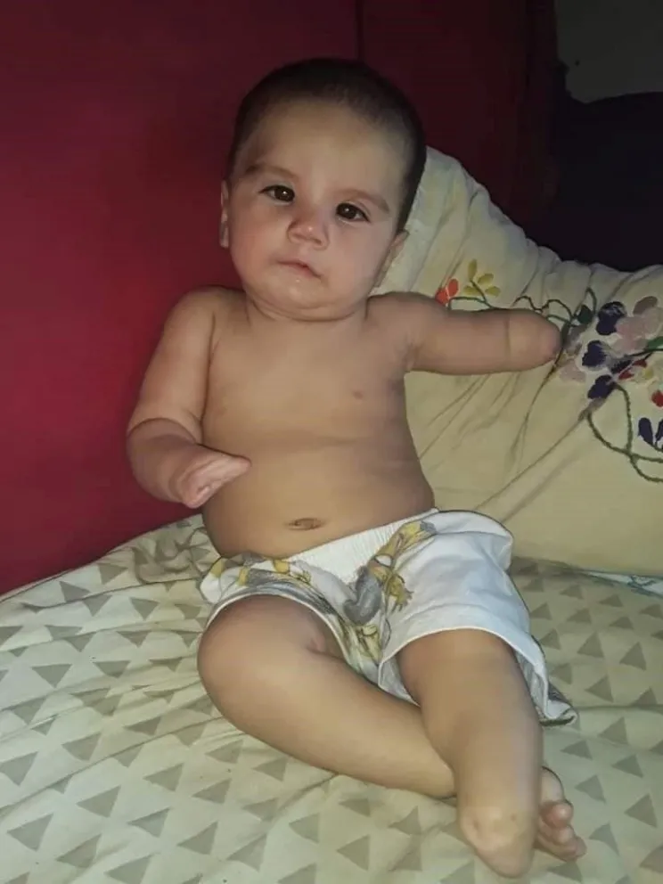 Nació sin un brazo, una pierna y una mano: su familia pide ayuda desesperada