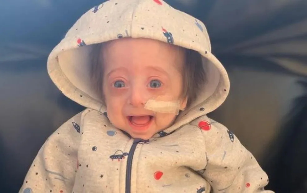 La impresionante historia de Vito: nació con el síndrome de "Benjamin Button"