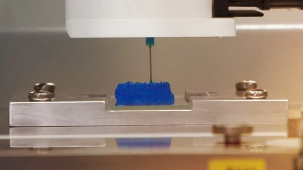 Expertos imprimen en 3D el primer tumor cerebral maligno activo