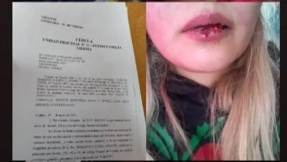 Denunció a su ex pareja por violento: "Hoy me animo a sacarle la careta"