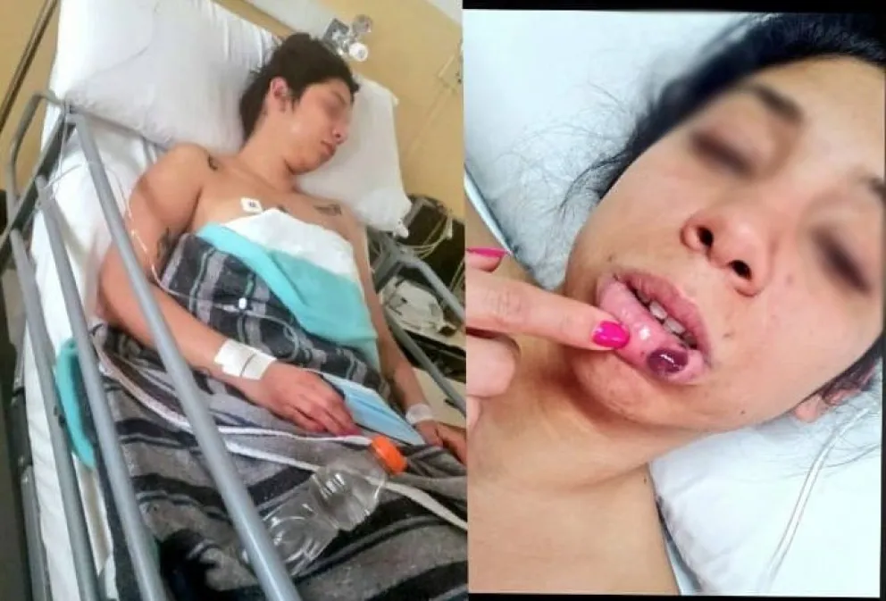 La siguió durante 20 cuadras, le dio una paliza y la dejó en terapia