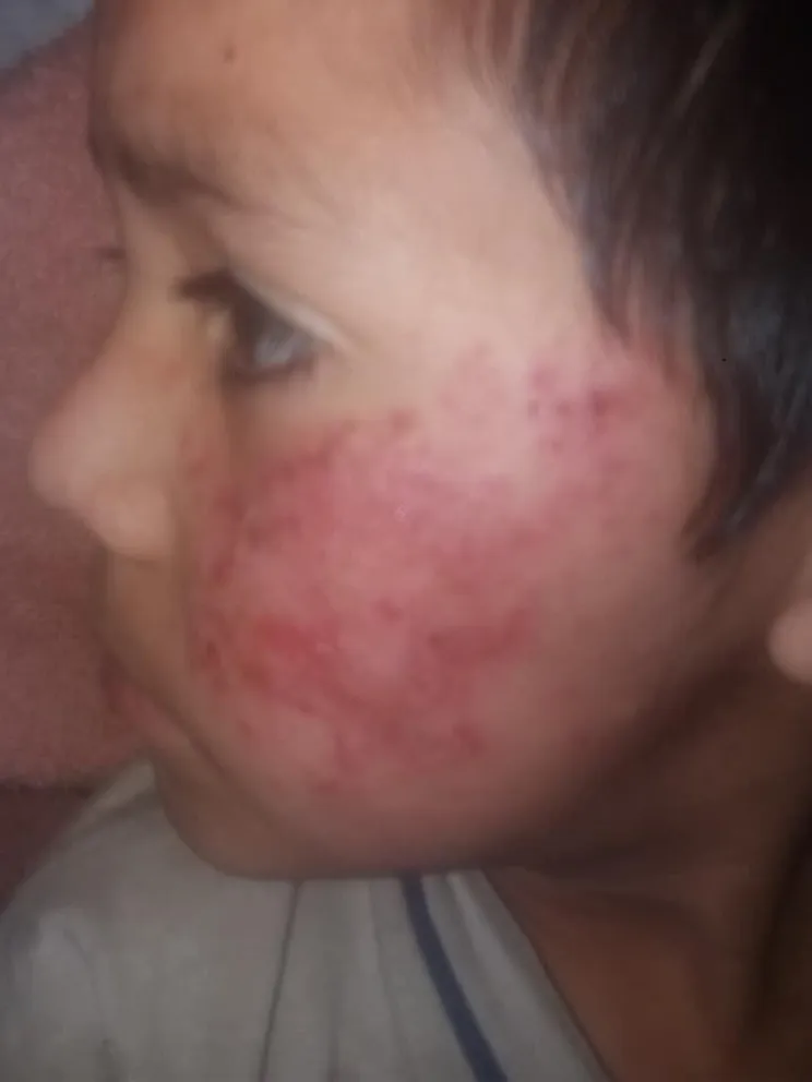 El drama de una mamá que pide ayuda por su hijo de 7 años