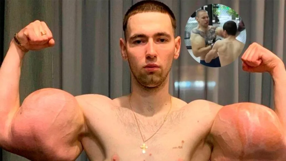 ¡Impactante!: Al Popeye ruso le "explotó" un brazo en pleno combate