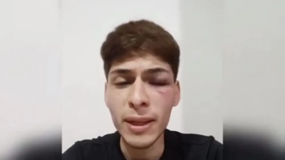 Un joven no binario con síndrome de Asperger fue atacado por una patota