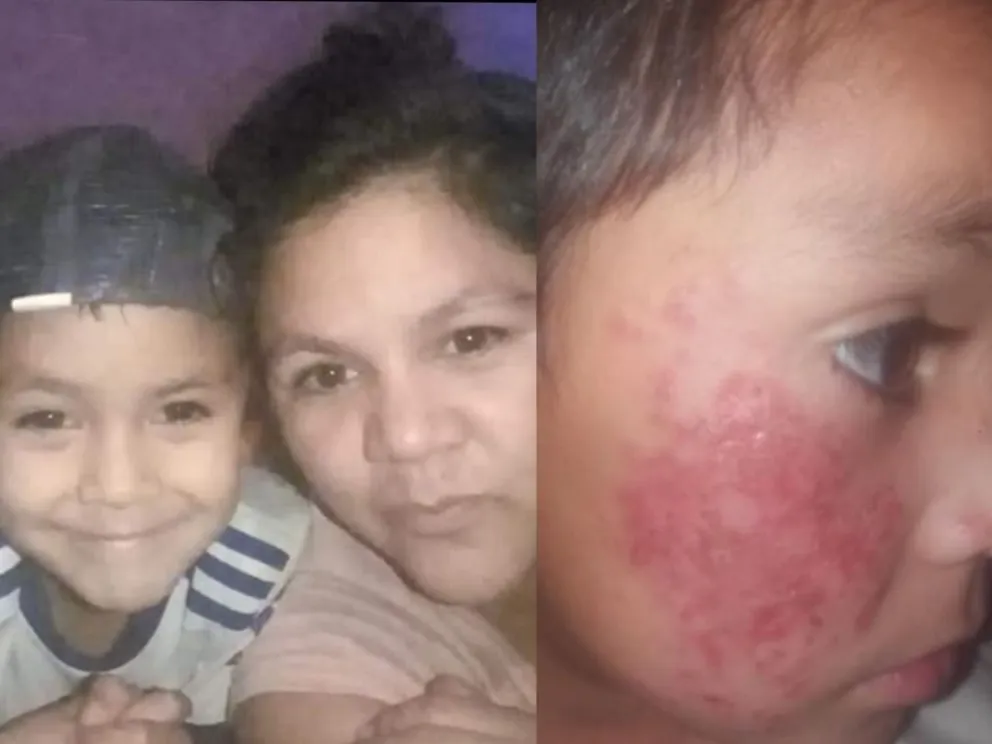 Cuando se juega con la ilusión: Franquito todavía no tiene su medicación