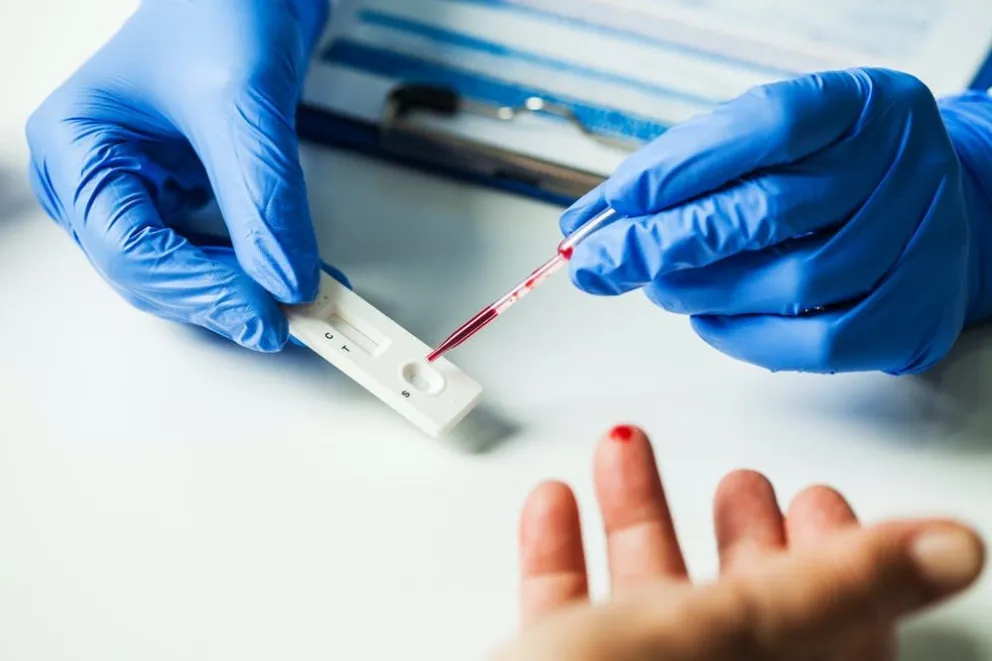Anuncian "Rapi-test" para control de enfermedades de transmisión sexual