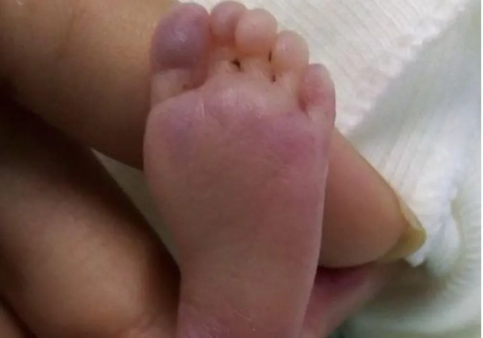 Un ángel subió al cielo, y el consuelo de los padres fue agradecer al personal de salud