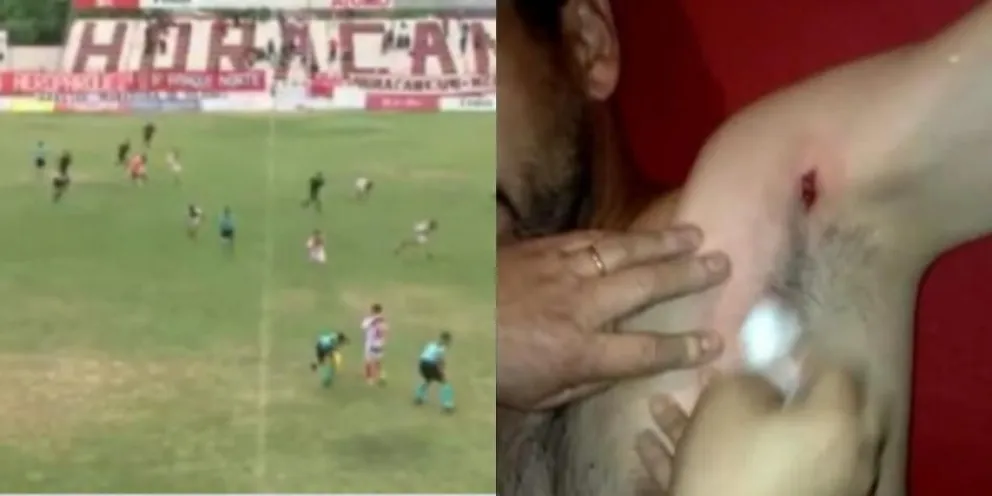 Escándalo y tiroteo en el Federal A: un DT fue baleado en pleno partido