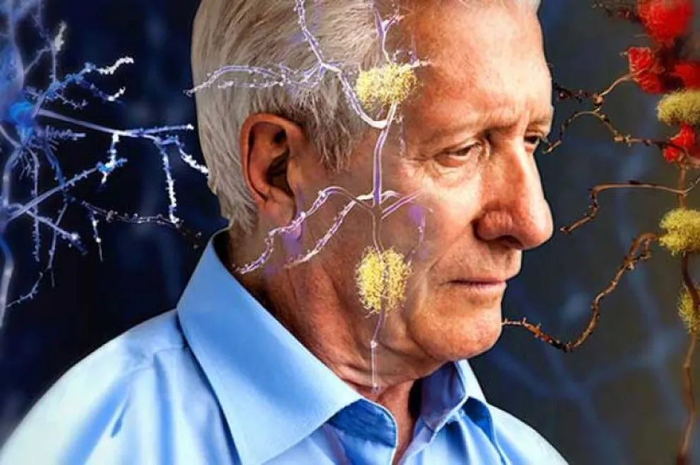 Alzheimer y demencia: científicos descubren lo que causa la muerte de células cerebrales 