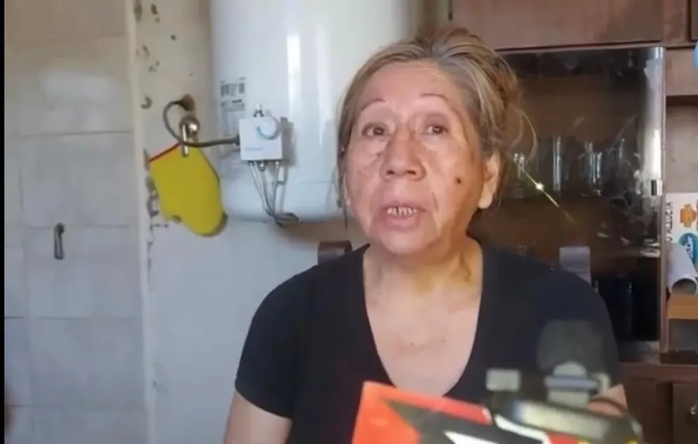 Desgarrador relato de la mujer que recibió un tiro en la cara por parte de un delincuente: “Vi que tenía odio”