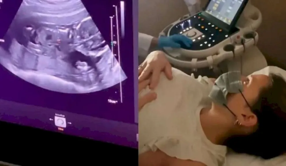 Bebé en camino: Mica Viciconte compartió la ecografía de Luca