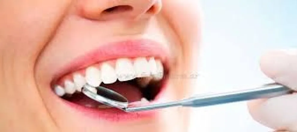 Cáncer bucal, la concientización y prevención son fundamentales 