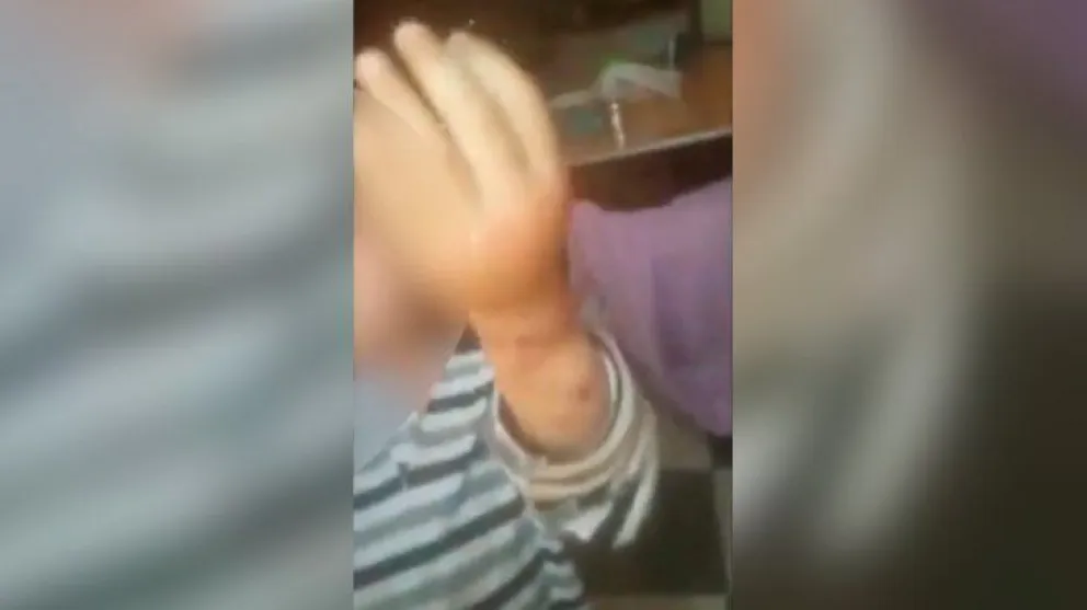Otra vez el maltrato infantil: Un niño fue encontrado atado y golpeado porque “se portaba mal"