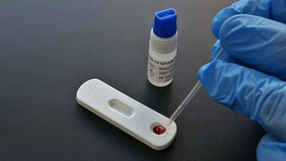 Los autotest para coronavirus estarían a la venta en farmacias desde enero 