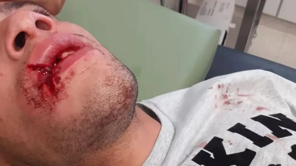 Otra vez la Tercera Bajada de Las Grutas se convirtió en un campo de batalla