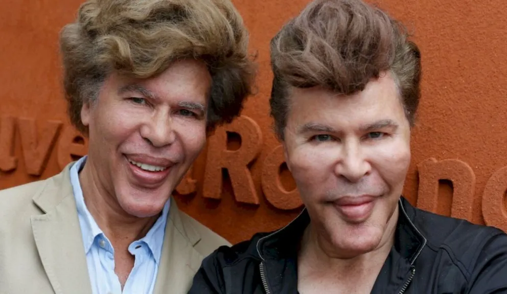 Fallecieron con seis días de diferencia los gemelos más conocidos del mundo 