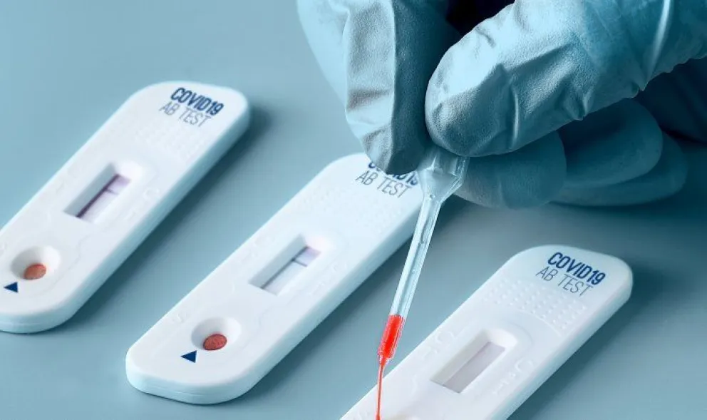 La ANMAT autorizó el uso de cuatro autotest de Covid-19